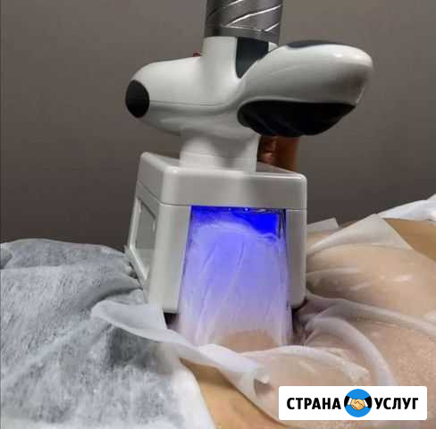 Криолиполиз Санкт-Петербург - изображение 1