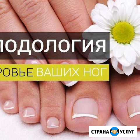 Услуги подолога Евпатория - изображение 1