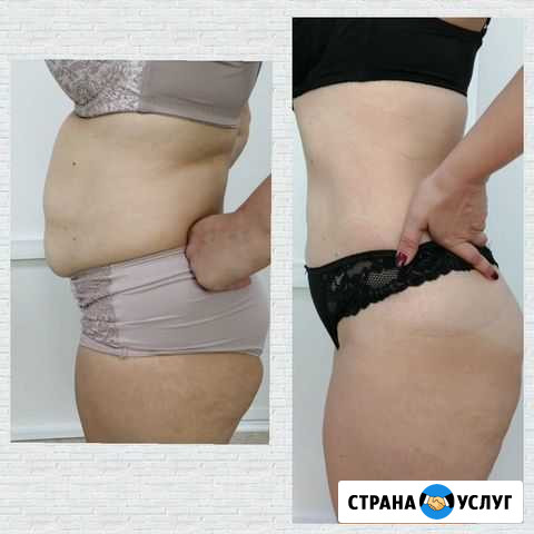 Миостимуляция Сызрань - изображение 1