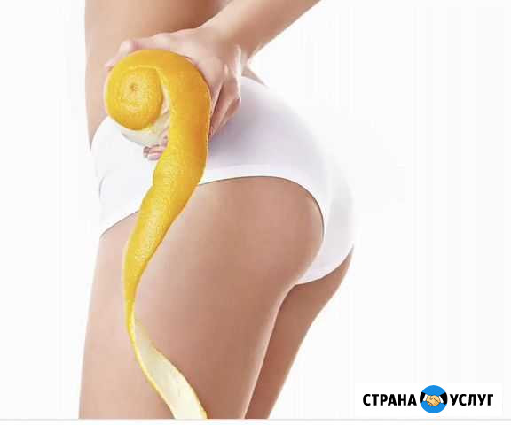Антицеллюлитный массаж Казань - изображение 1