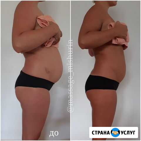 Массаж коррекция фигуры Симферополь - изображение 1